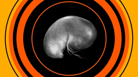 Where To Find Every Larval Tear in Elden Ring.